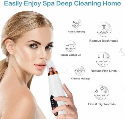 Rechargeable Blackhead Removal Device