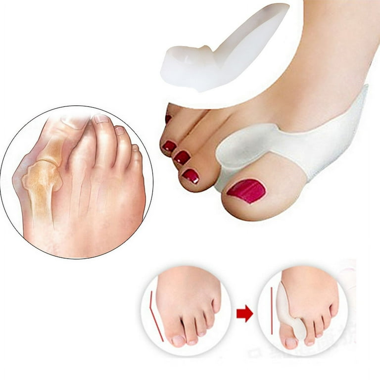 Toe Separator