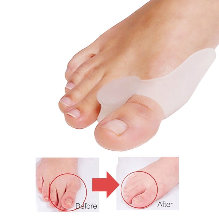 Toe Separator